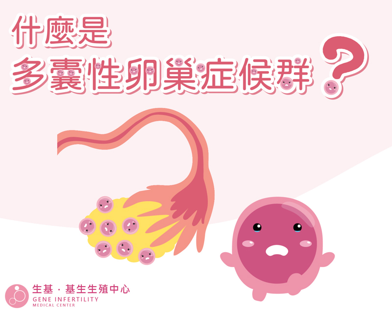 什麼是多囊性卵巢症候群？