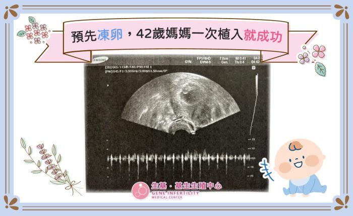 事前に卵子を凍結、42歳ママが一回の胚移植で妊娠に成功