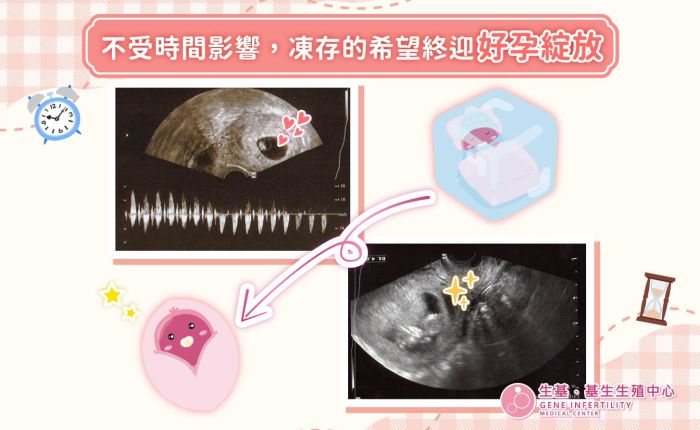 不受時間影響，凍存的希望終迎好孕綻放💕