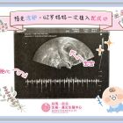 1140416生基張醫師凍卵個案_繁1 複本