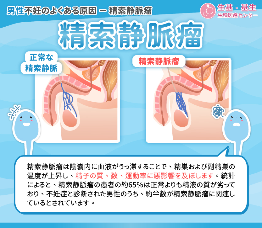 精索靜脈曲張_工作區域 1 精索靜脈曲張_工作區域 1