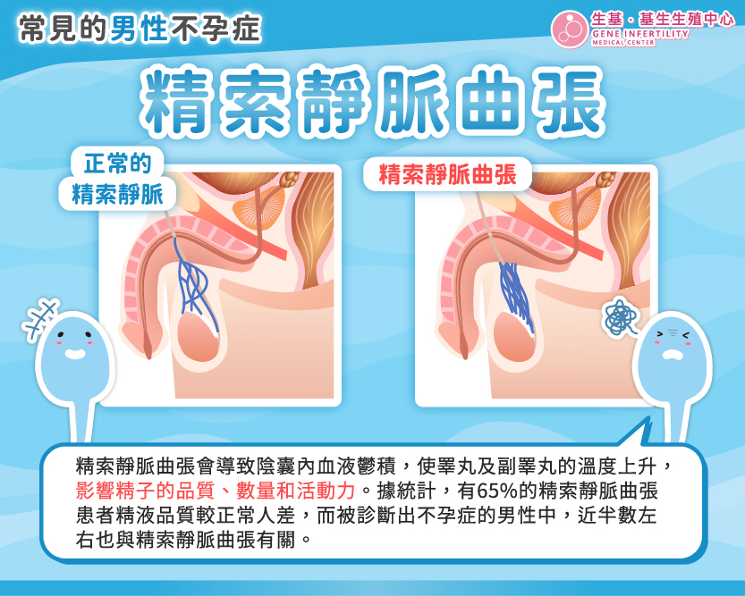精索靜脈曲張_工作區域 1 精索靜脈曲張_工作區域 1
